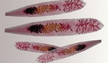 Inson tanasida opizthorchis parazitlari