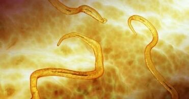 Inson tanasidagi pinworm parazitlari