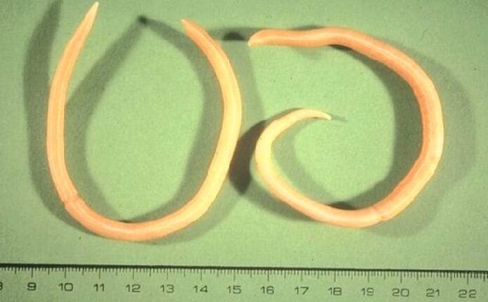 inson tanasidan pinworm