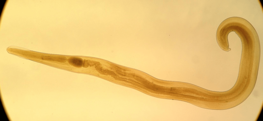 Pinworm bolalar orasida keng tarqalgan parazitdir. 